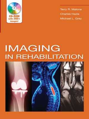 cover image of Imaging In Rehabilitation